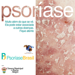 Iniciativa visa a conscientizar sobre a doença
