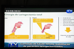 Cirurgia de laringe foi o tema de hoje na Comissão de Saúde